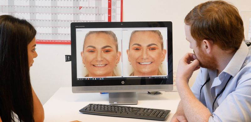 How Does Digital Smile Design Work?